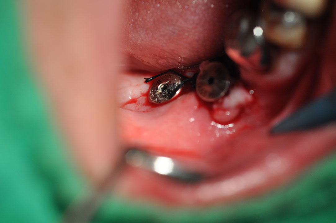 %_tempFileNameImplant%20123b8%