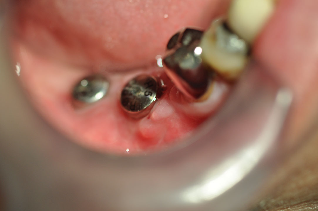 %_tempFileNameImplant%20123c1%
