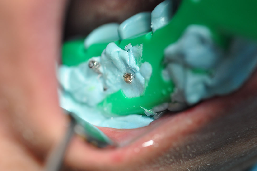 %_tempFileNameImplant%20123c4%