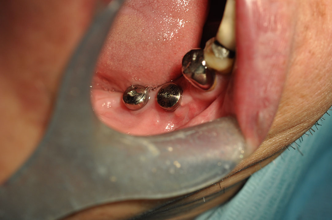 %_tempFileNameImplant%20123c7%