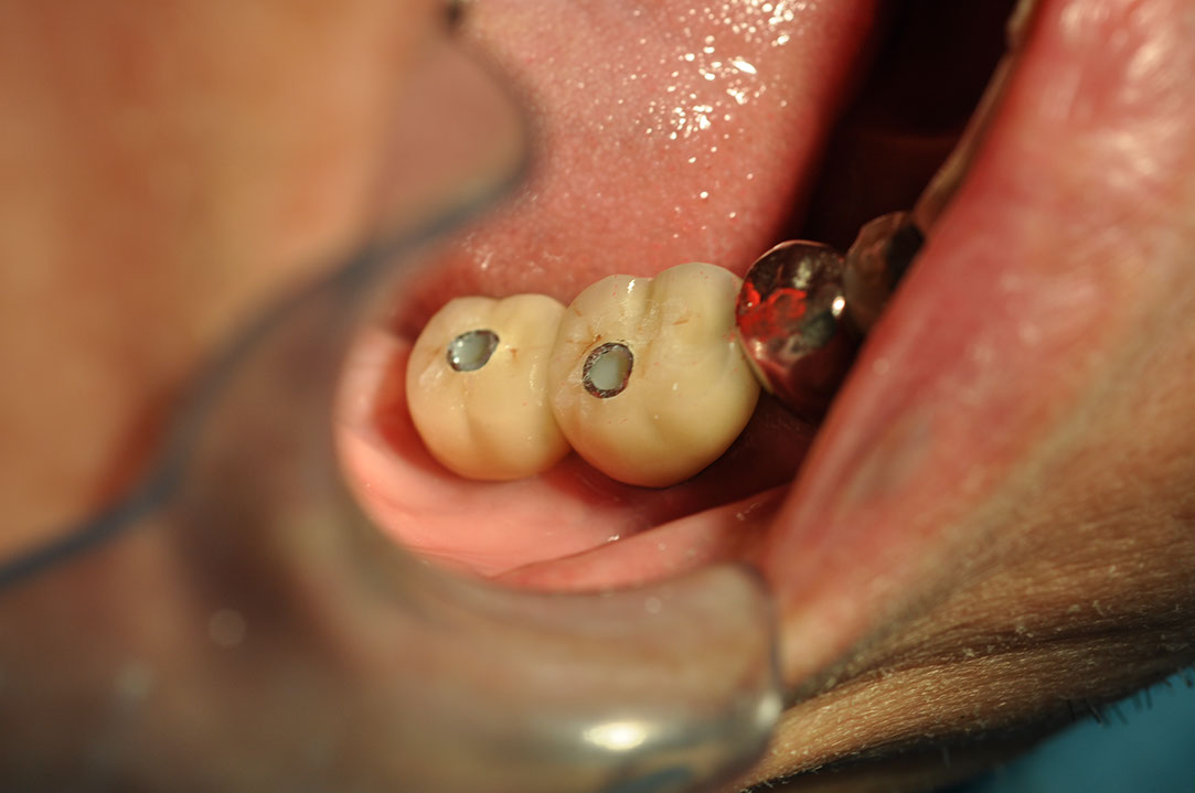 %_tempFileNameImplant%20123d1%