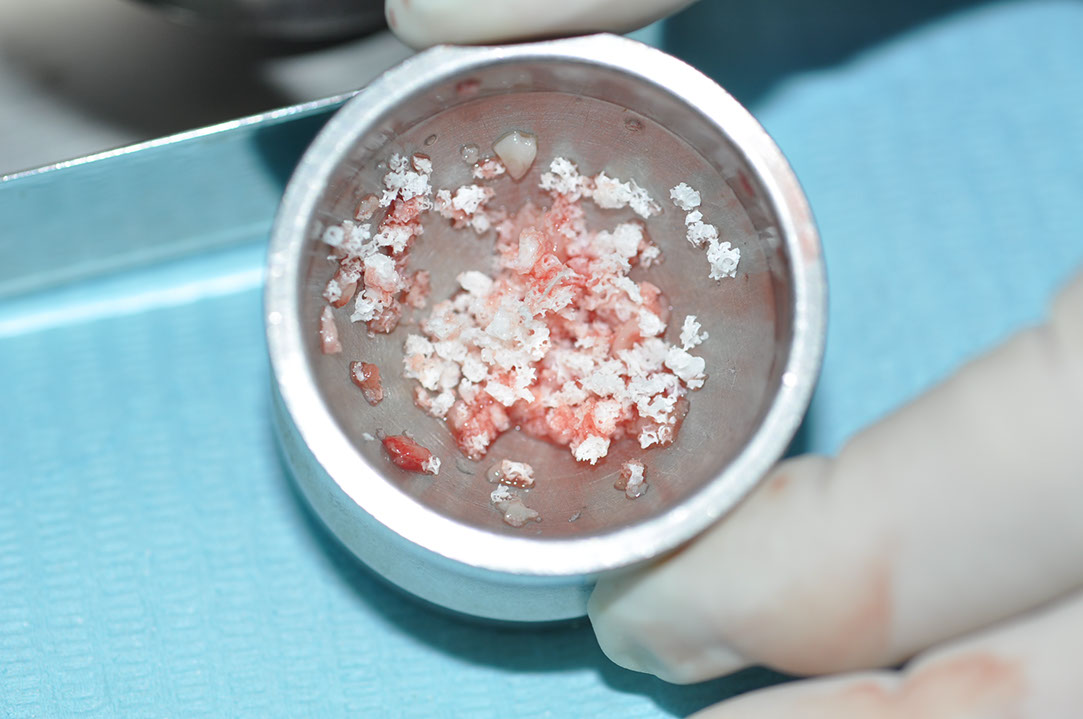 %_tempFileNameImplant%20124a7%