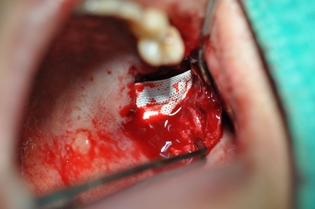 %_tempFileNameImplant%20124b3%