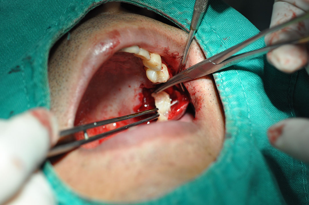 %_tempFileNameImplant%20124b4%