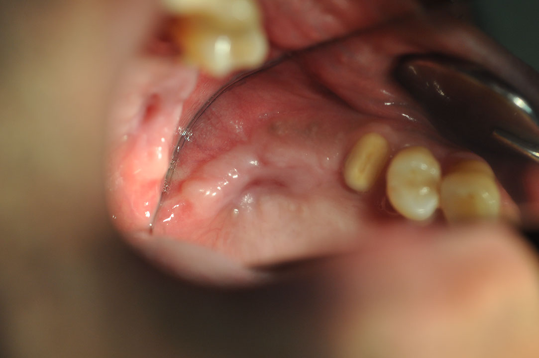 %_tempFileNameImplant%20124b7%