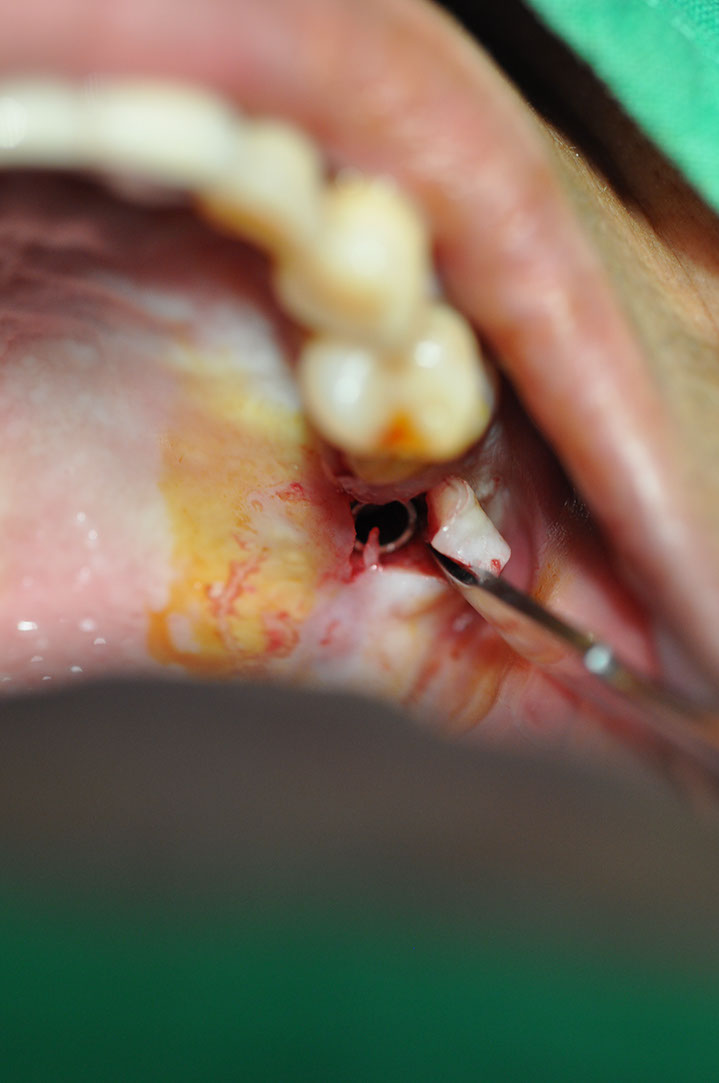 %_tempFileNameImplant%20124b8%