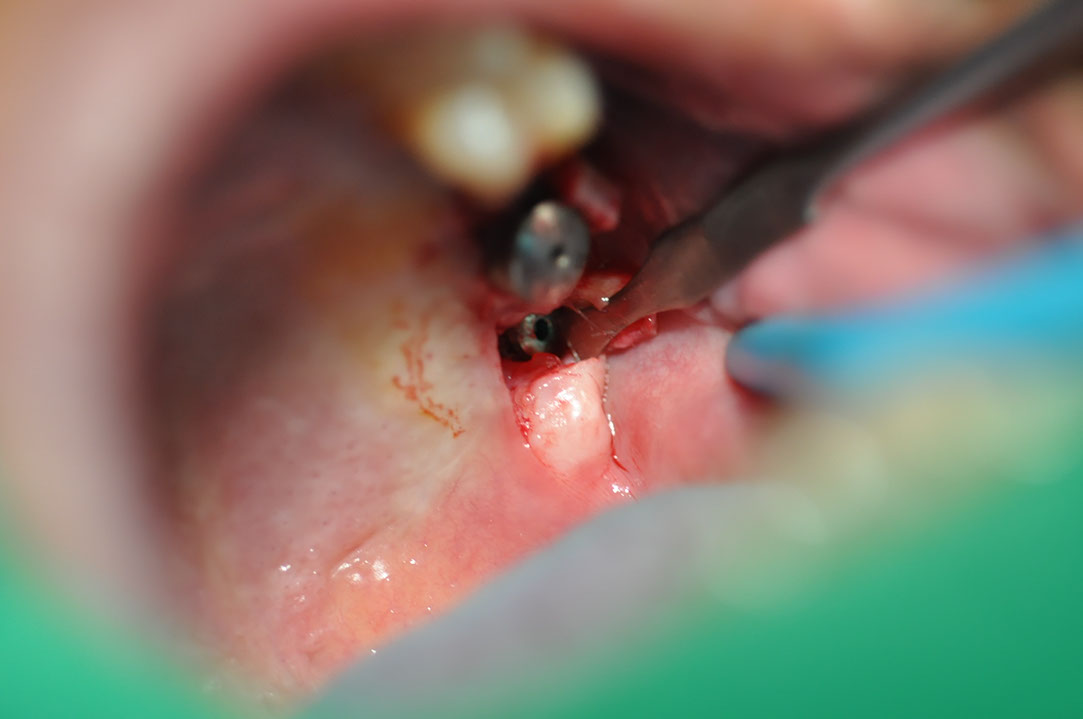 %_tempFileNameImplant%20124b9%