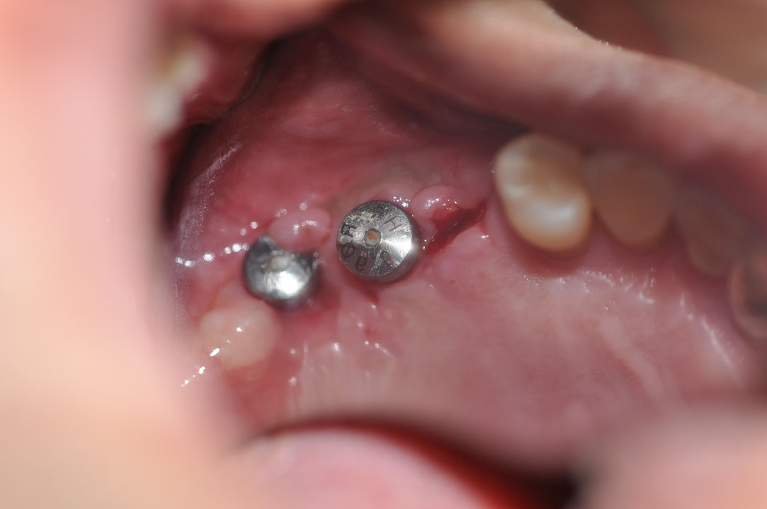 %_tempFileNameImplant%20124c3%
