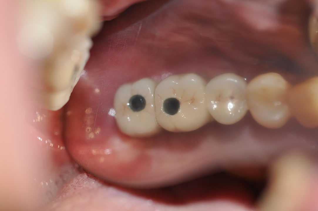 %_tempFileNameImplant%20124c5%