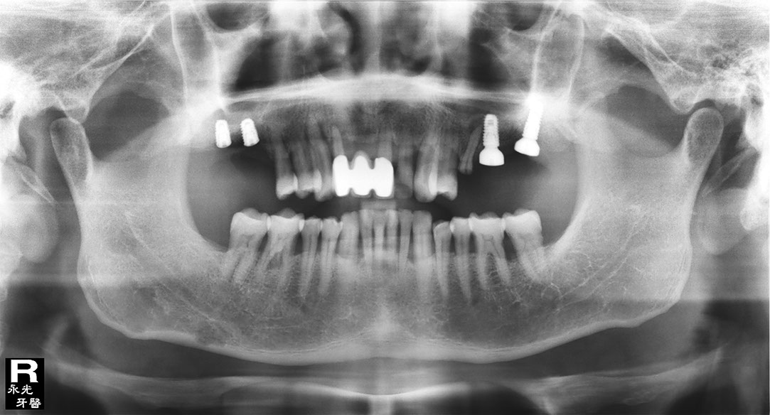 %_tempFileNameImplant%20124d3%