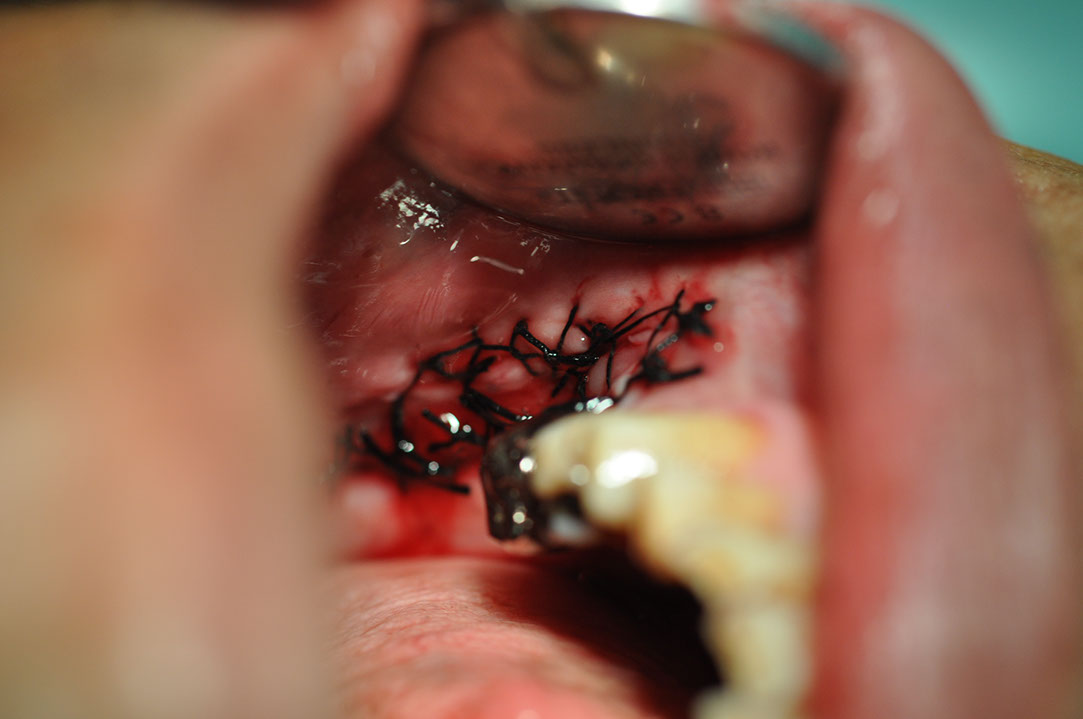 %_tempFileNameImplant%20125a7%