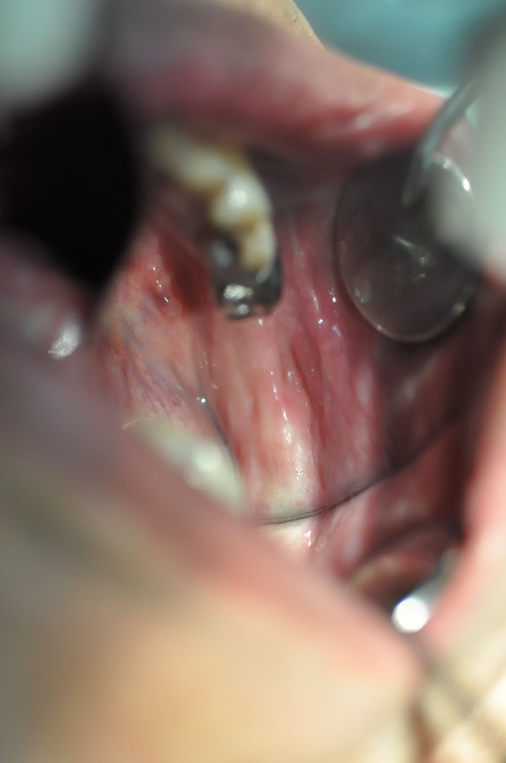 %_tempFileNameImplant%20125b4%