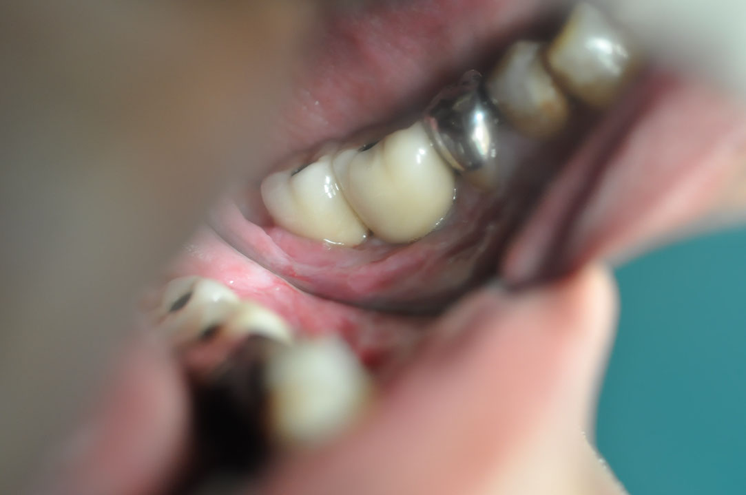 %_tempFileNameImplant%20125c5%