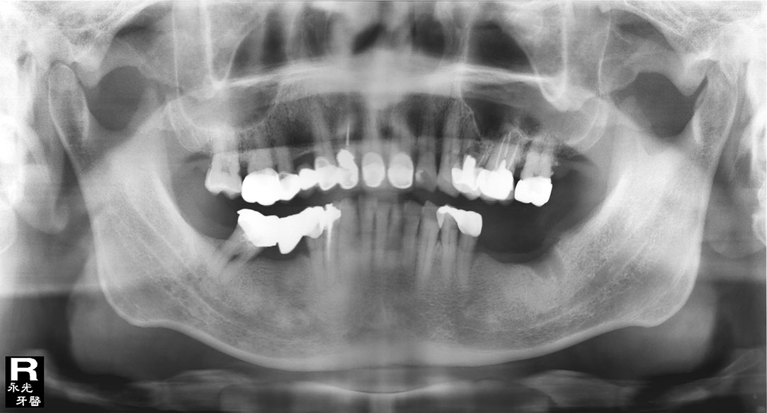 %_tempFileNameImplant%20125d2%