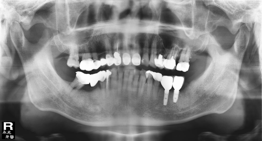 %_tempFileNameImplant%20125d5%