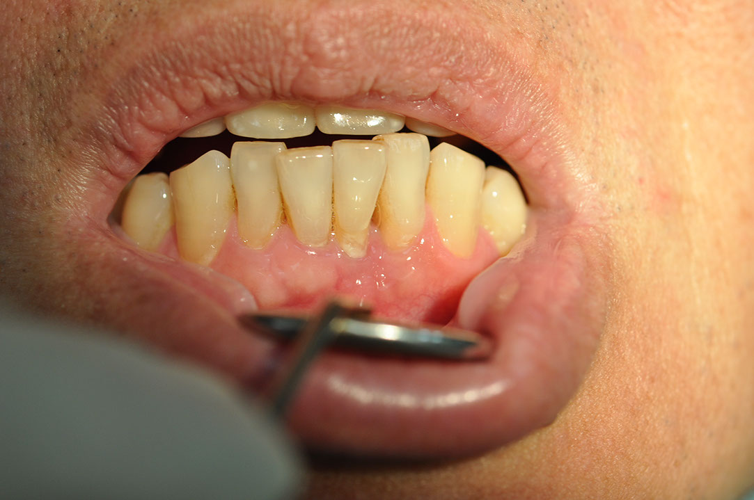 %_tempFileNameImplant%20126a1%