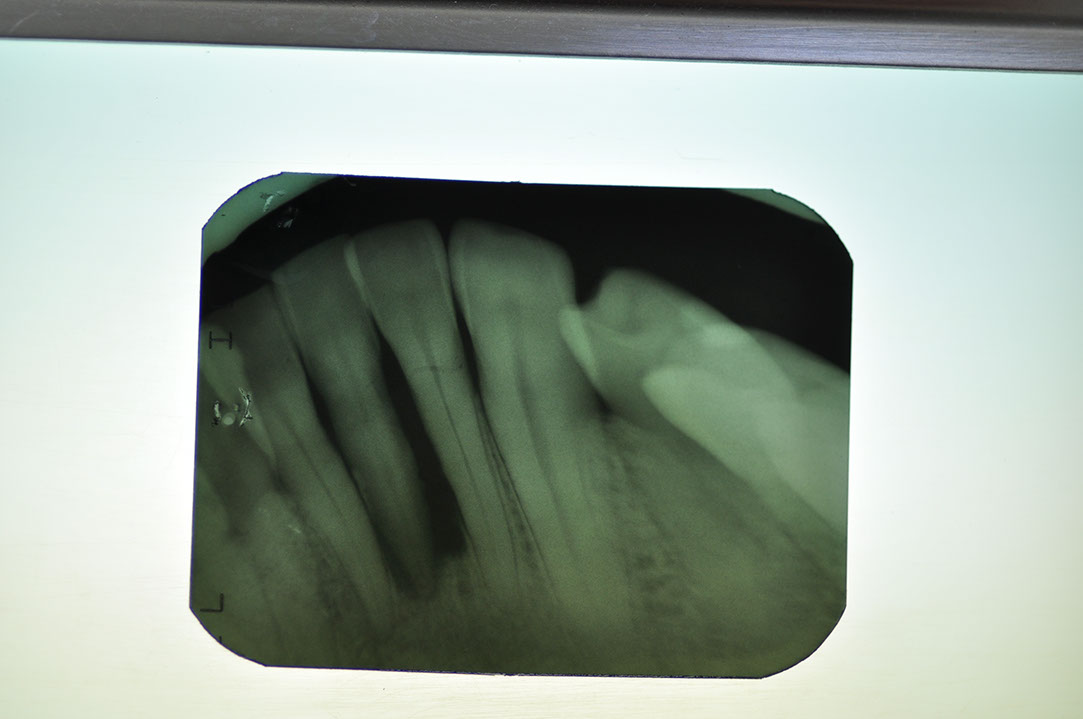 %_tempFileNameImplant%20126a2%
