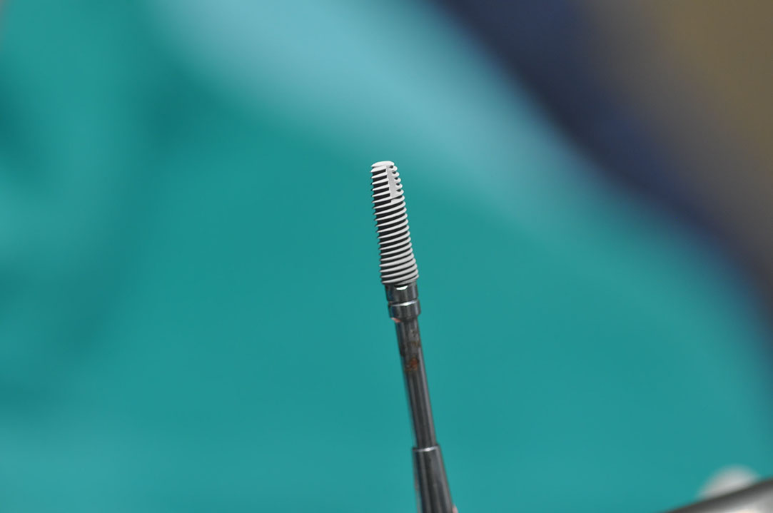 %_tempFileNameImplant%20126a5%
