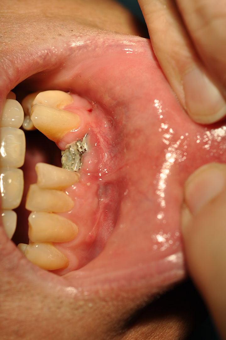 %_tempFileNameImplant%20126b1%