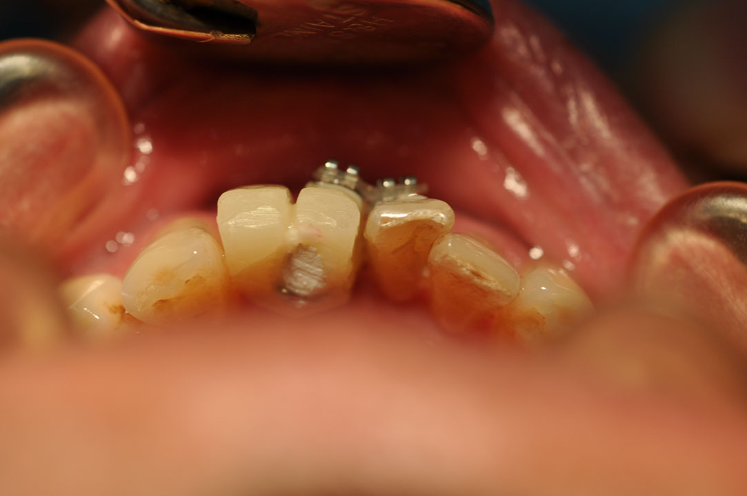 %_tempFileNameImplant%20126b2%