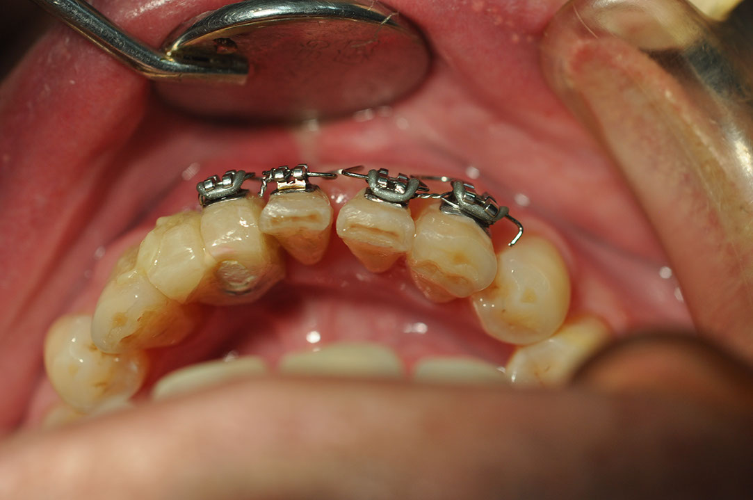 %_tempFileNameImplant%20126b3%
