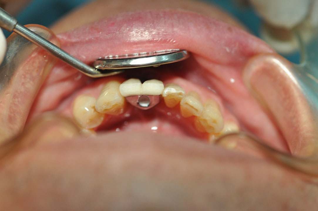 %_tempFileNameImplant%20126b4%