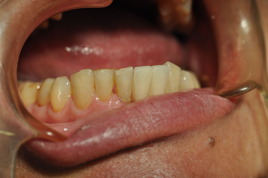 %_tempFileNameImplant%20126b5%