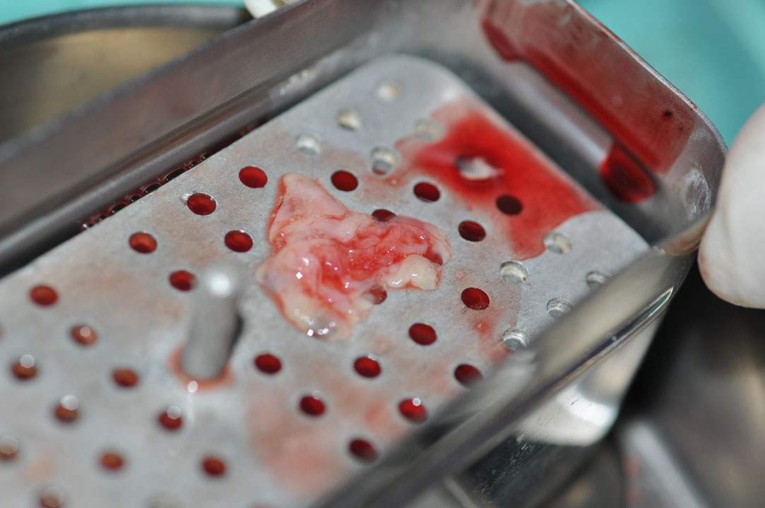 %_tempFileNameImplant%20127a8%