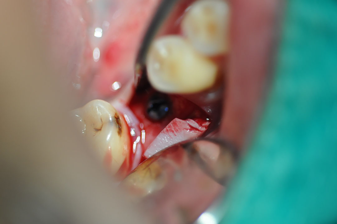 %_tempFileNameImplant%20127a9%