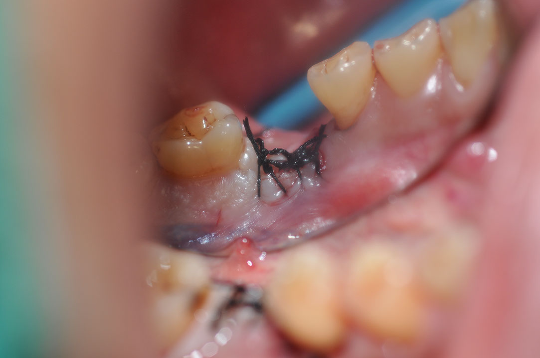 %_tempFileNameImplant%20127b2%
