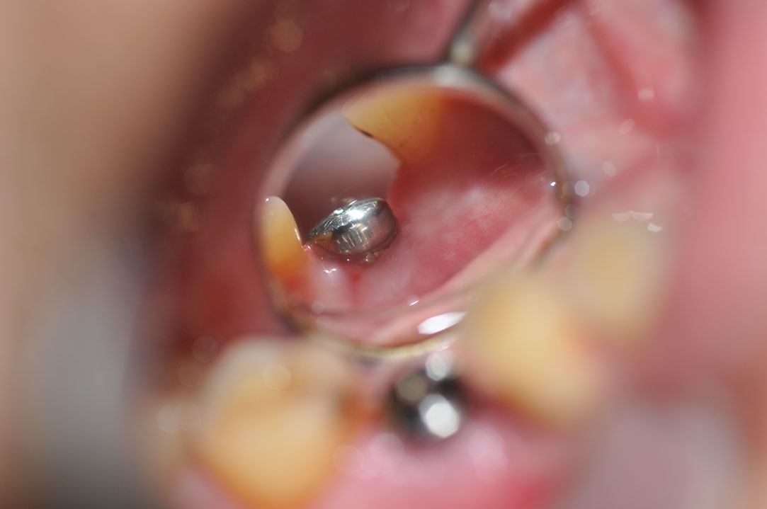 %_tempFileNameImplant%20127b6%