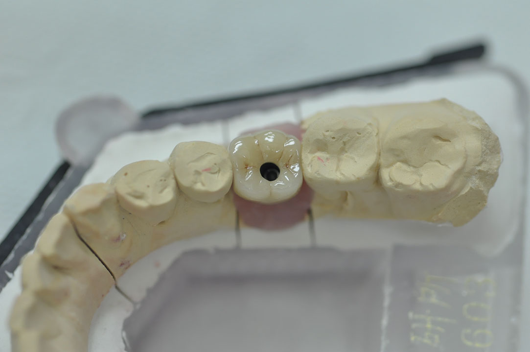 %_tempFileNameImplant%20127b7%