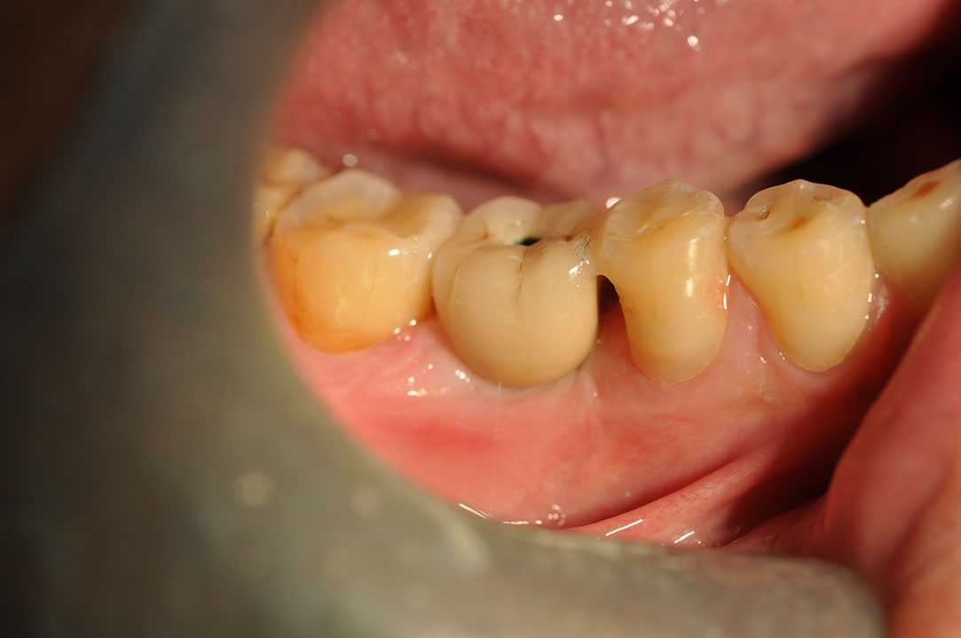 %_tempFileNameImplant%20127c1%