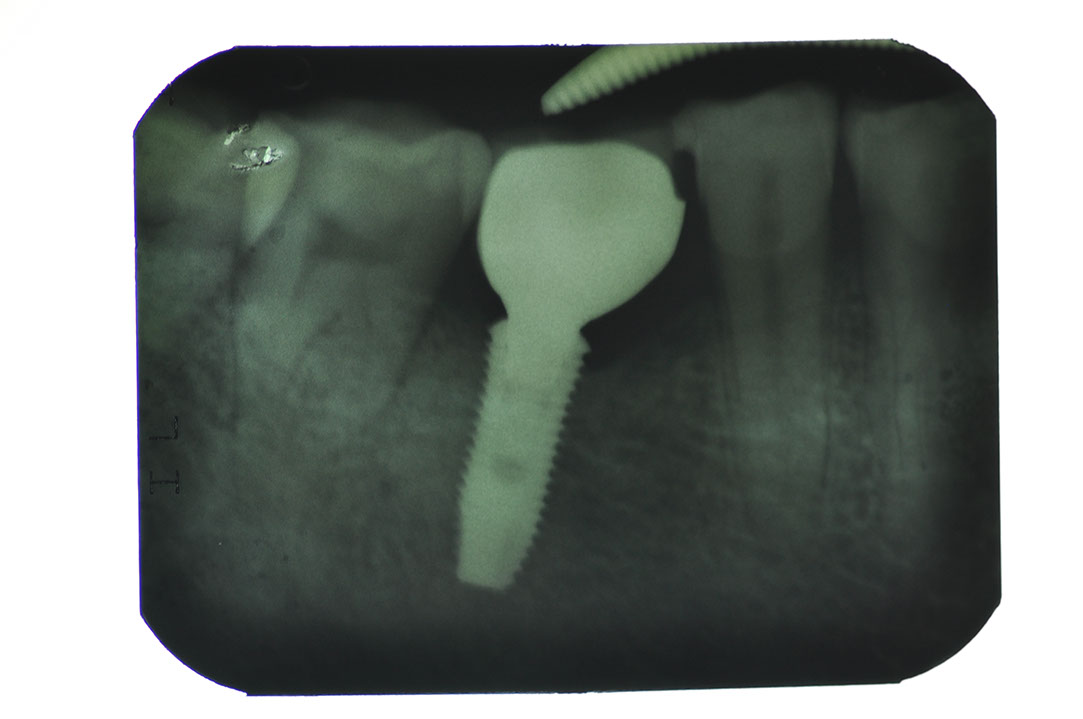 %_tempFileNameImplant%20127d4%