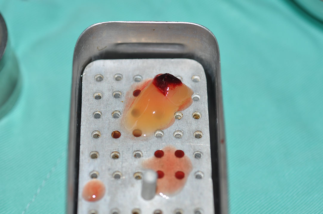%_tempFileNameImplant%20128a4%