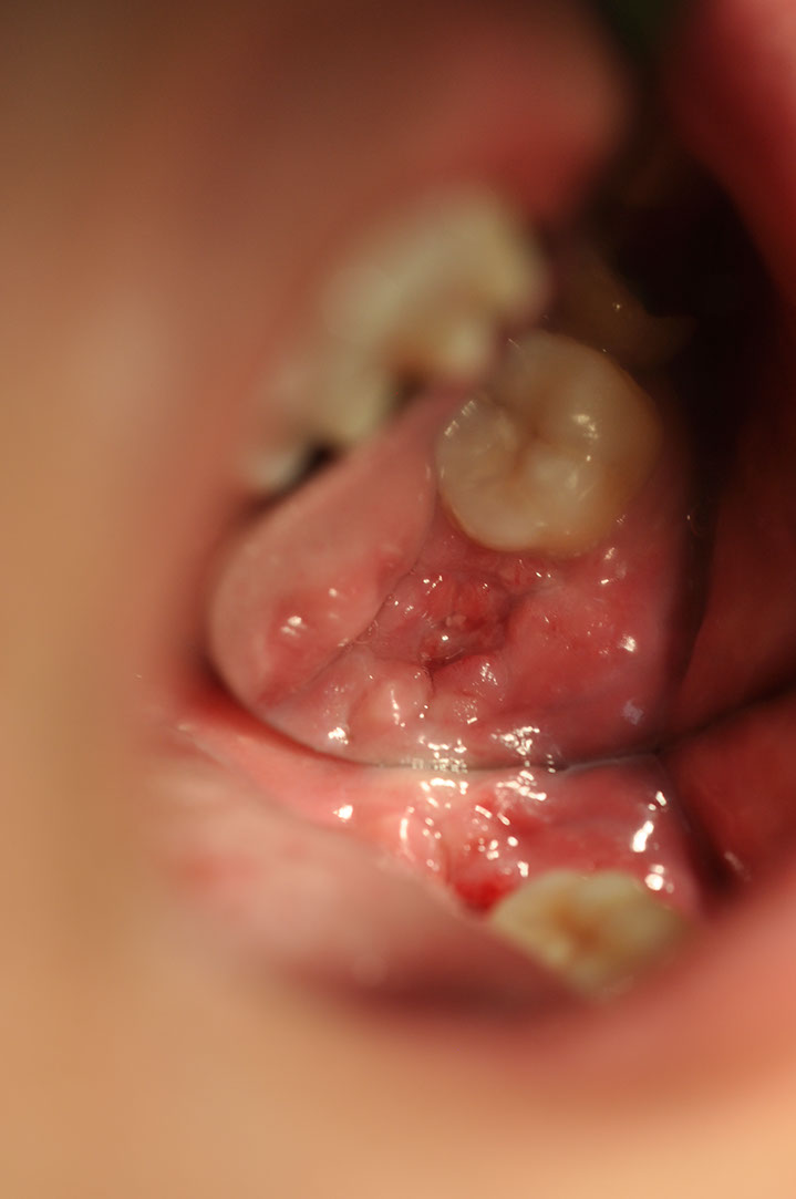 %_tempFileNameImplant%20128a5%