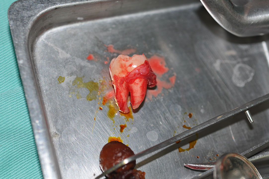 %_tempFileNameImplant%20128a7%
