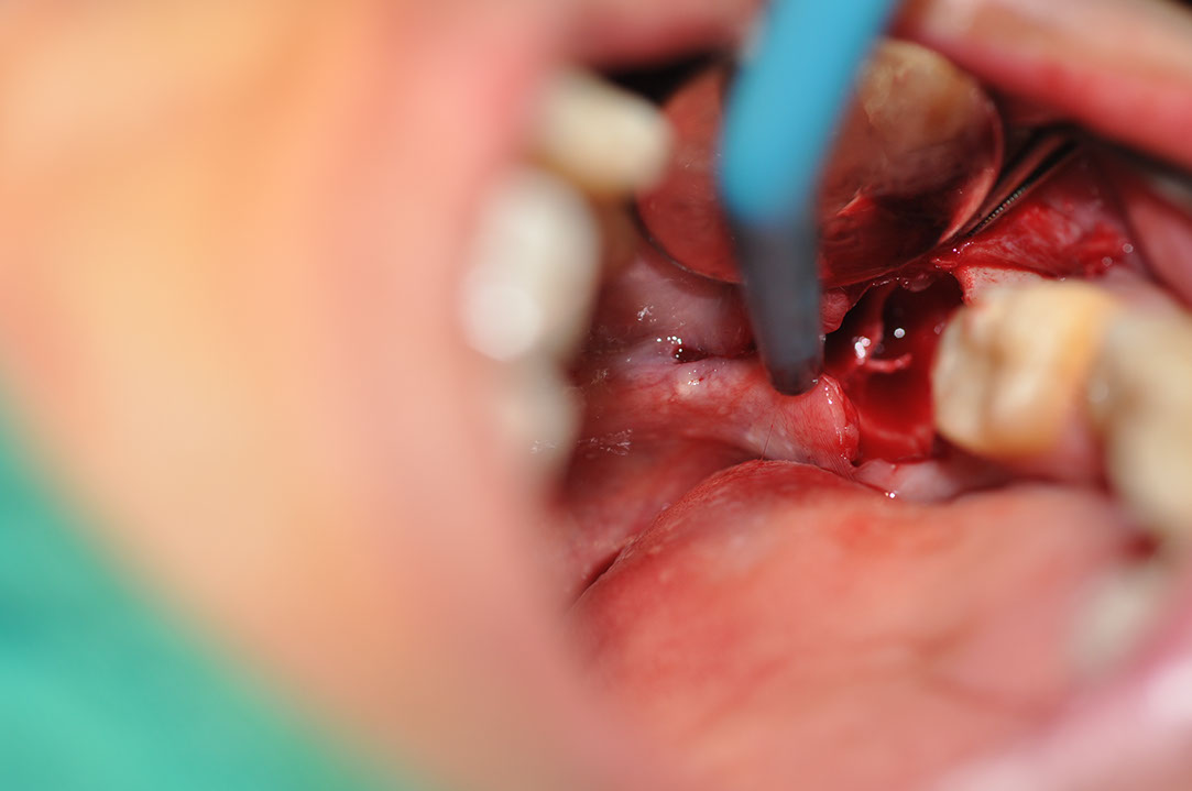 %_tempFileNameImplant%20128a8%