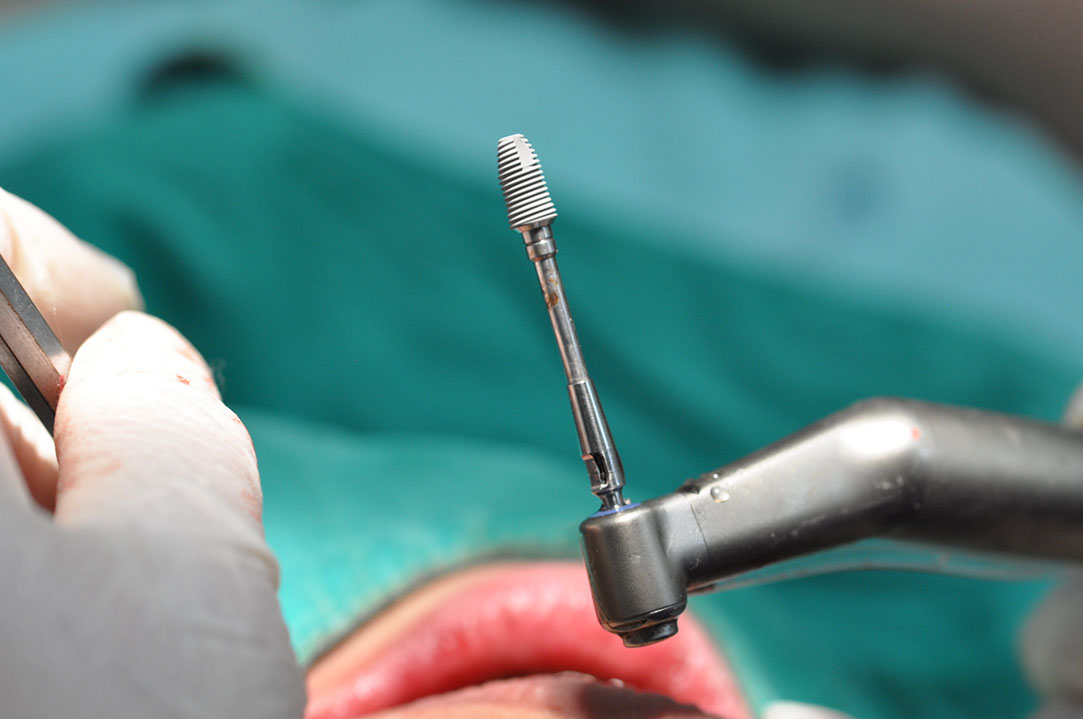 %_tempFileNameImplant%20128a9%