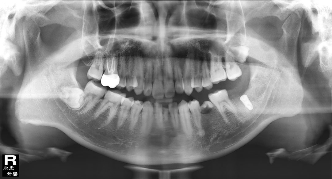 %_tempFileNameImplant%20128d4%