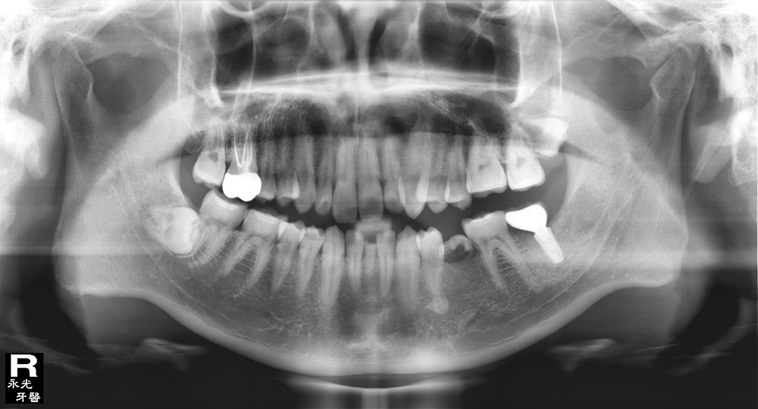 %_tempFileNameImplant%20128d6%