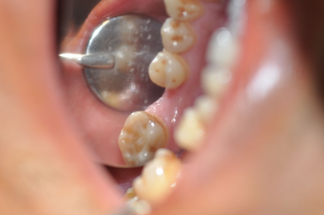 %_tempFileNameImplant%20129a2%