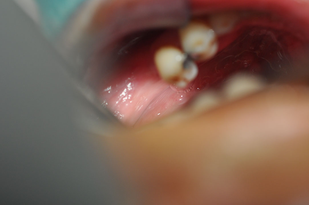 %_tempFileNameImplant%20129a3%