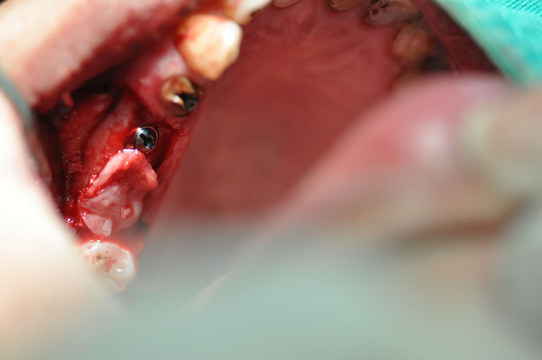 %_tempFileNameImplant%20129b2%