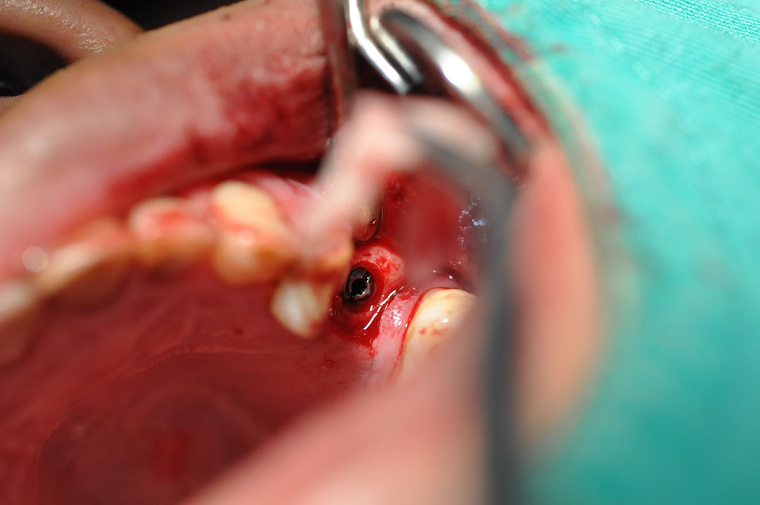 %_tempFileNameImplant%20129b3%