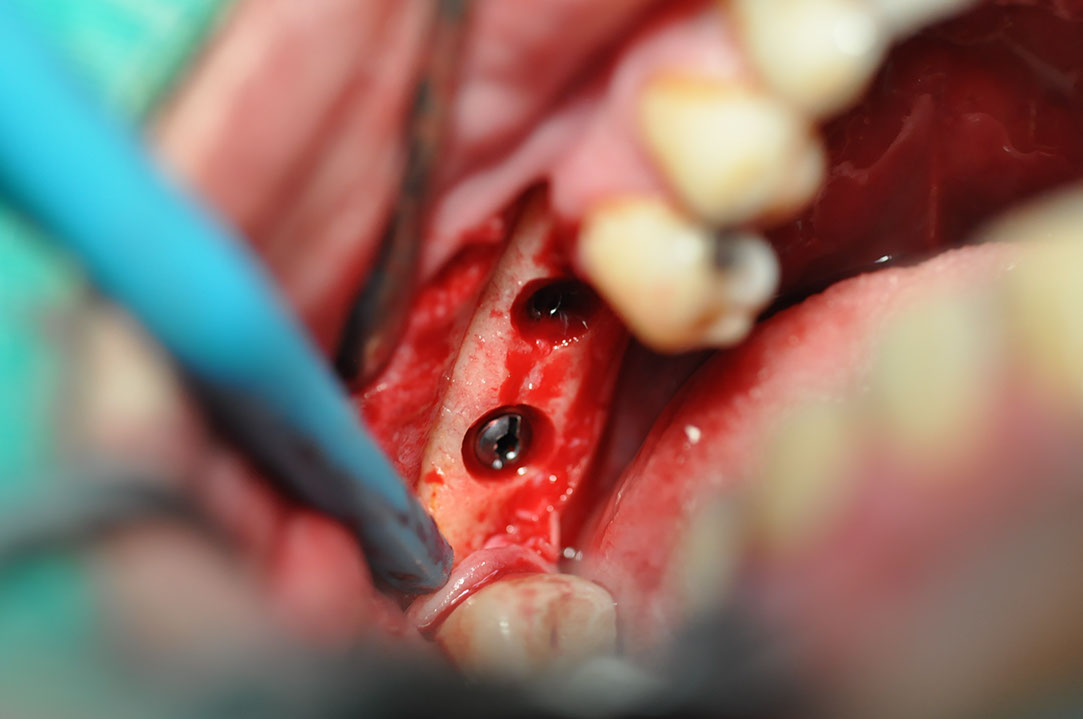 %_tempFileNameImplant%20129b6%
