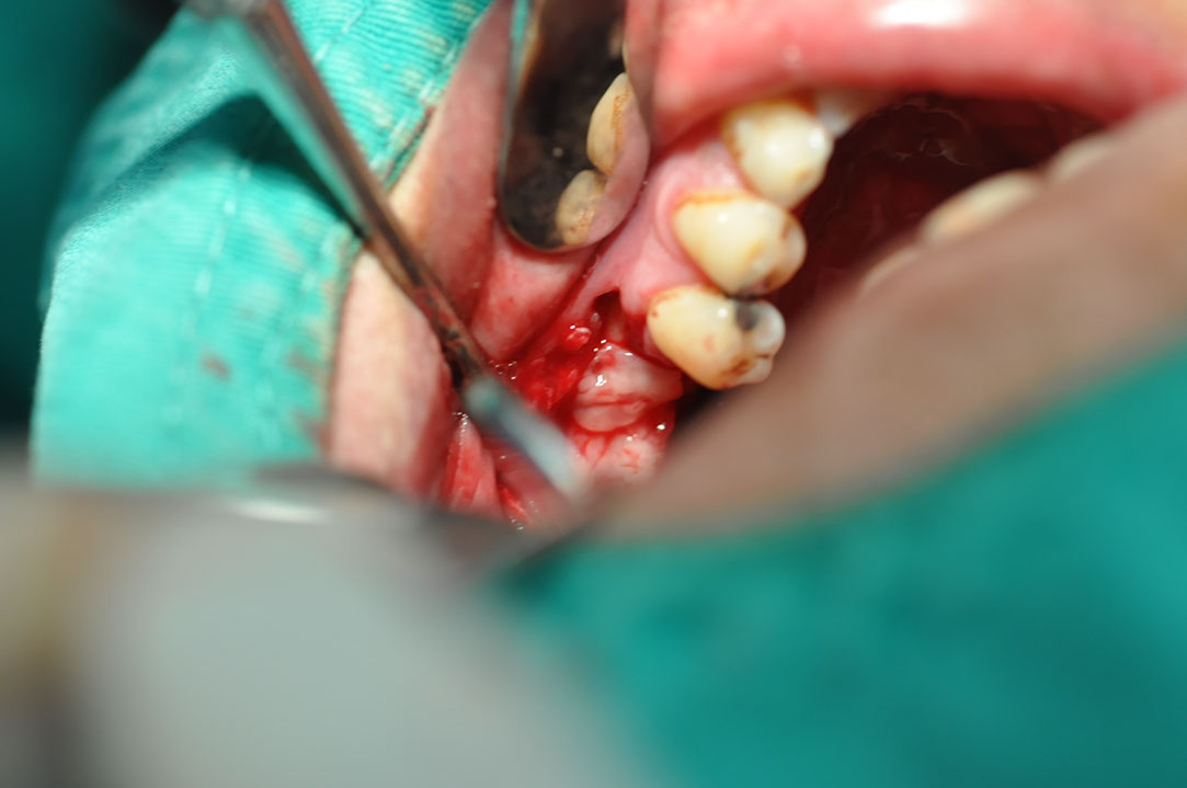 %_tempFileNameImplant%20129b7%