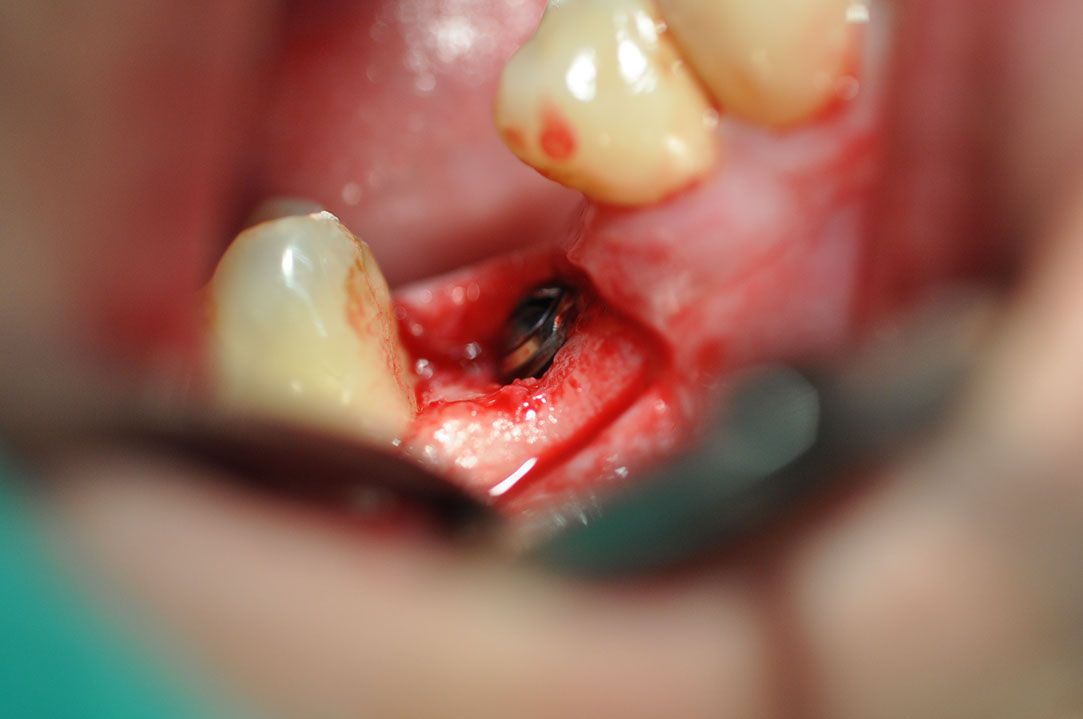 %_tempFileNameImplant%20129b8%