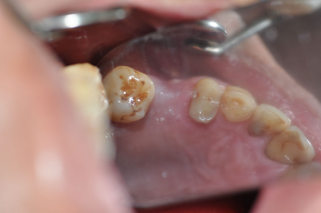 %_tempFileNameImplant%20129c3-1%