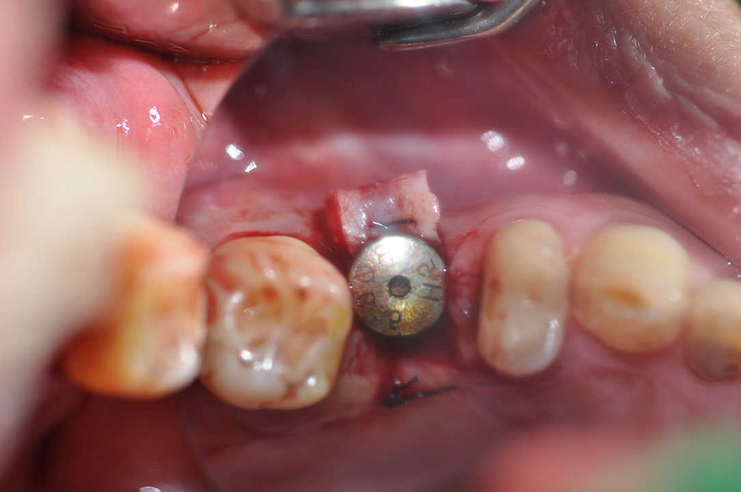 %_tempFileNameImplant%20129c4%